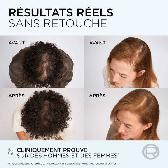Elseve Fiber Booster Shampooing Sans Sulfates Anti-Chute Enrichi en AMINEXIL 200ML