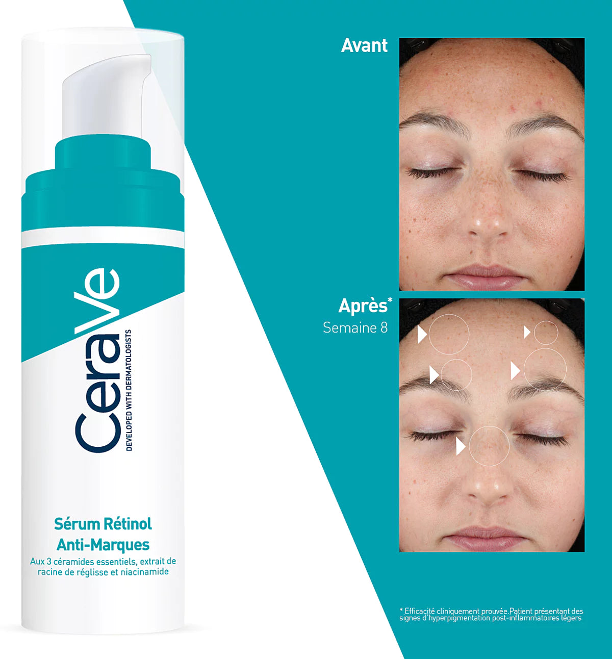 CeraVe Sérum Rétinol Anti-Marques – 30 ml