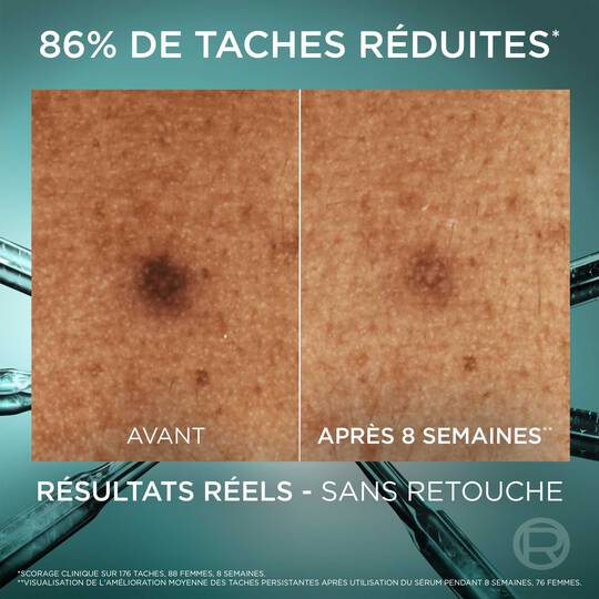 L’Oréal Paris Bright Reveal – Sérum Anti-Taches à la Niacinamide