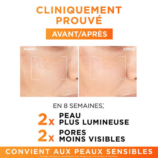 L’Oréal Paris Revitalift Clinical – Sérum 12 % Vitamine C Pure 30ML